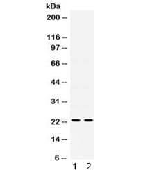 IGFBP5 Antibody