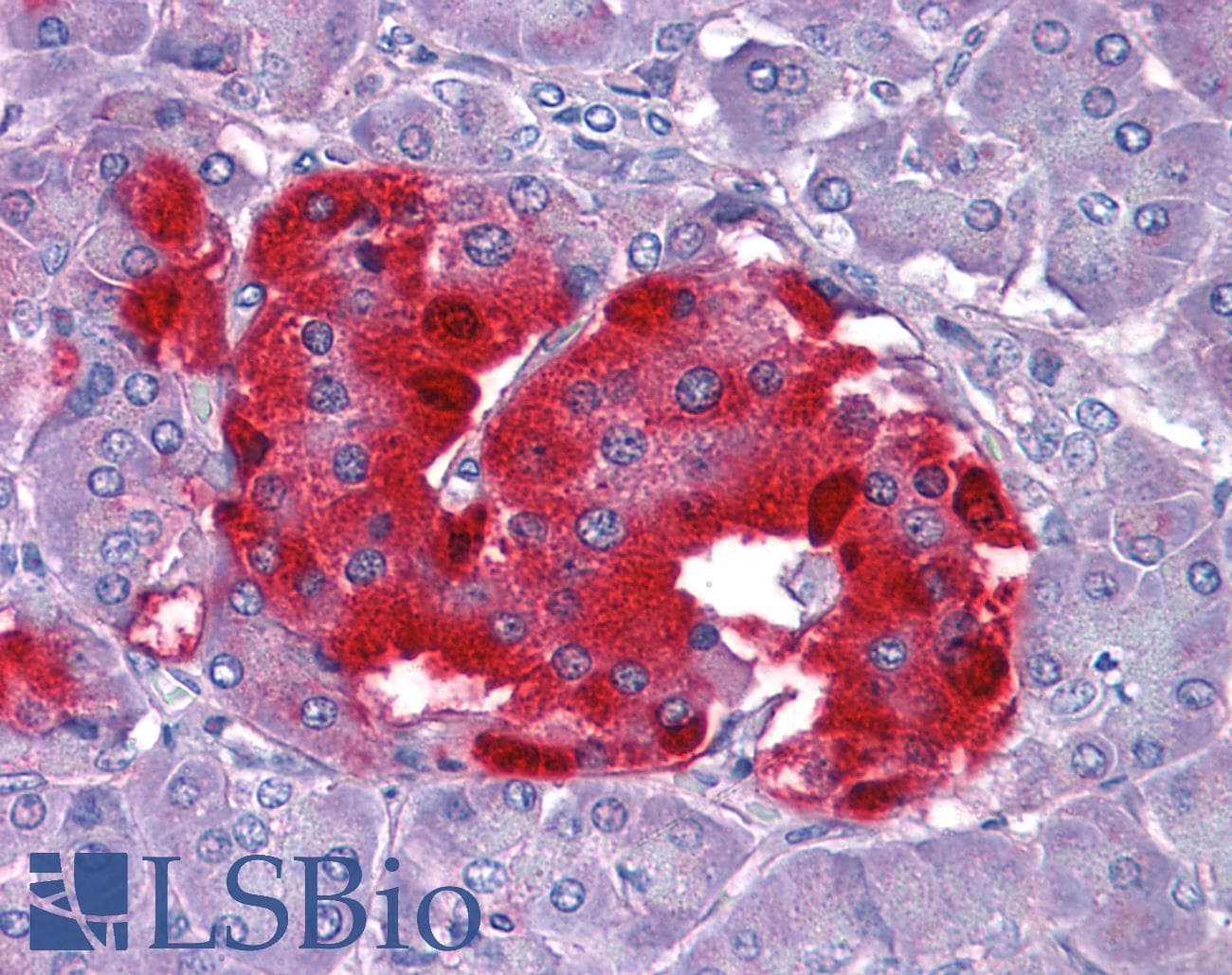 IHC-plus™ Polyclonal Goat anti-Human CHGA / Chromogranin A Antibody (aa85-97, IHC, WB)