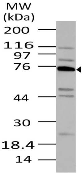 Polyclonal Rabbit anti-Human TNFAIP2 Antibody (aa300-520, WB)