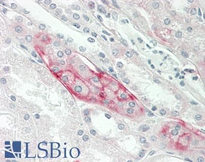 Polyclonal Rabbit anti-Human SLC44A2 / CTL2 Antibody (aa259-308, IHC, WB)