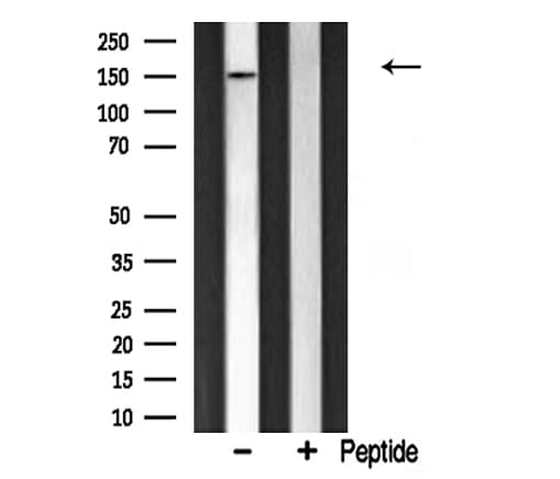CHAF1A / CAF1 Antibody