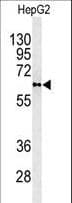 PLTP Antibody (aa451-479)