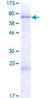 Human PARP15 Protein (Recombinant GST)