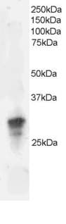 IHC-plus™ GRB2 Antibody (aa206-217)