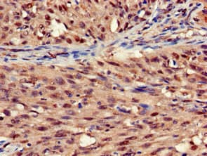 STOML3 Antibody