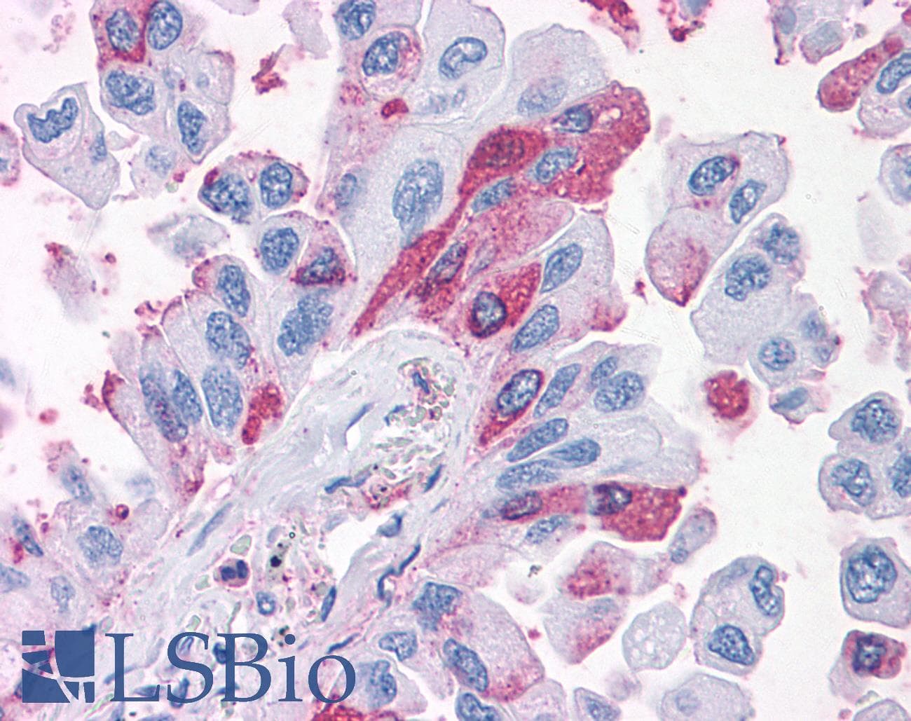 PathPlus™ PKD3 / PRKD3 Antibody (Internal)