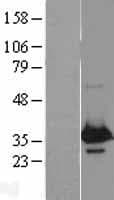 WBP2 Protein (Over-Expression Lysate Myc-DDK (Flag))