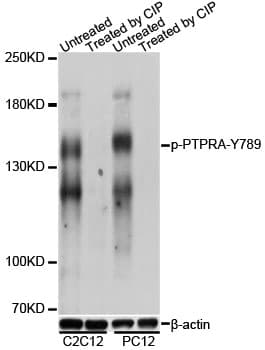 PTPRA / RPTP-Alpha Antibody (phospho-Tyr789)