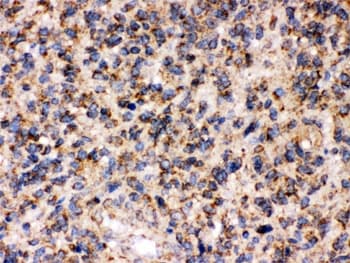 APBB1 / FE65 Antibody