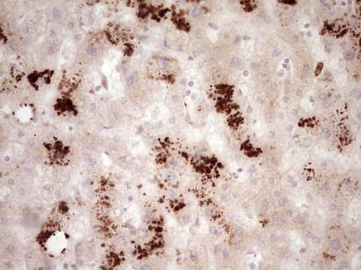 Monoclonal Mouse anti-Human RB1 / Retinoblastoma / RB Antibody (clone OTI1C3, aa309-590, IHC, WB)
