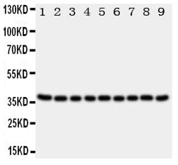 KLK10 / Kallikrein 10 Antibody (aa252-265)