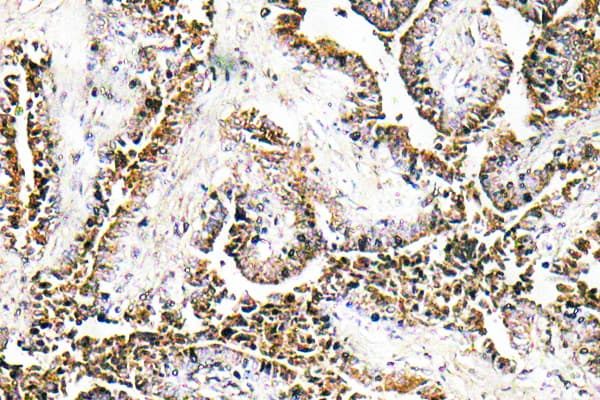 PPT1 / CLN1 Antibody (Ile65)