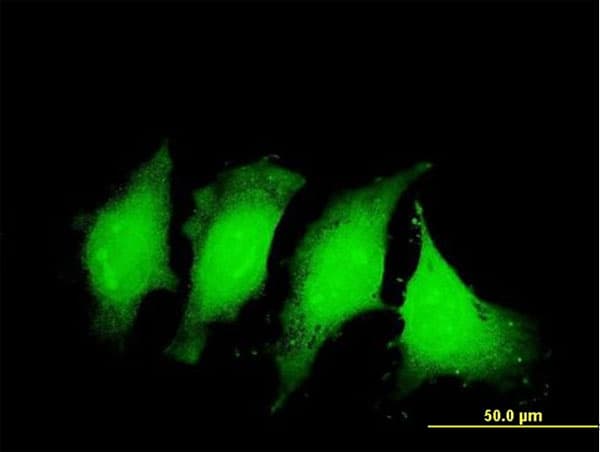 Monoclonal Mouse anti-Human IL-1B / IL-1 Beta Antibody (clone 2A8, IF, WB)