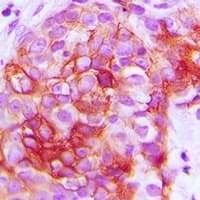 Polyclonal Rabbit anti-Human GIPR / GIP Receptor Antibody (Internal, IHC, IF, WB)