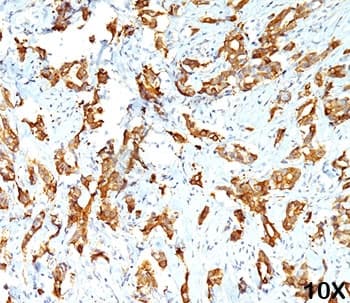 Monoclonal Mouse anti-Human HSPB1 / HSP27 Antibody (clone G3.1, Ready-to-Use, IHC, IF, WB)