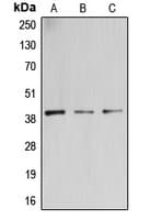 Polyclonal Rabbit anti-Human GALT4 / B3GALT4 Antibody (Internal, WB)