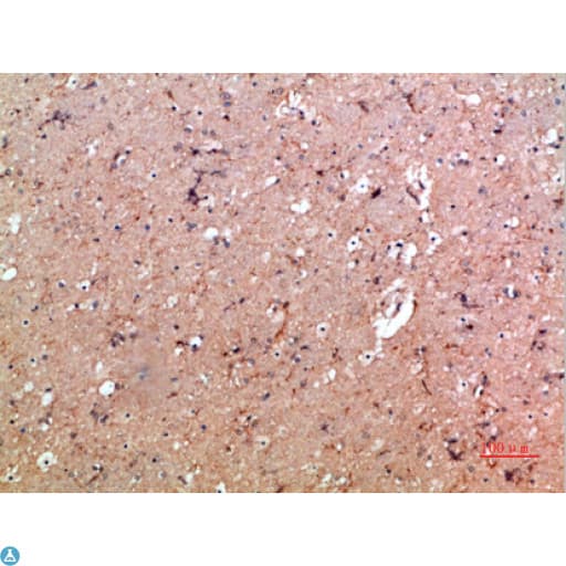 Polyclonal Rabbit anti-Human ITGAM / CD11b Antibody (IHC)