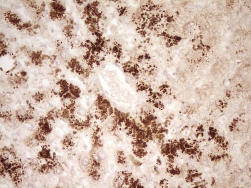 HGF / Hepatocyte Growth Factor Antibody (aa200-494, clone OTI3F2)
