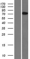 BBS10 Protein (Over-Expression Lysate Myc-DDK (Flag))