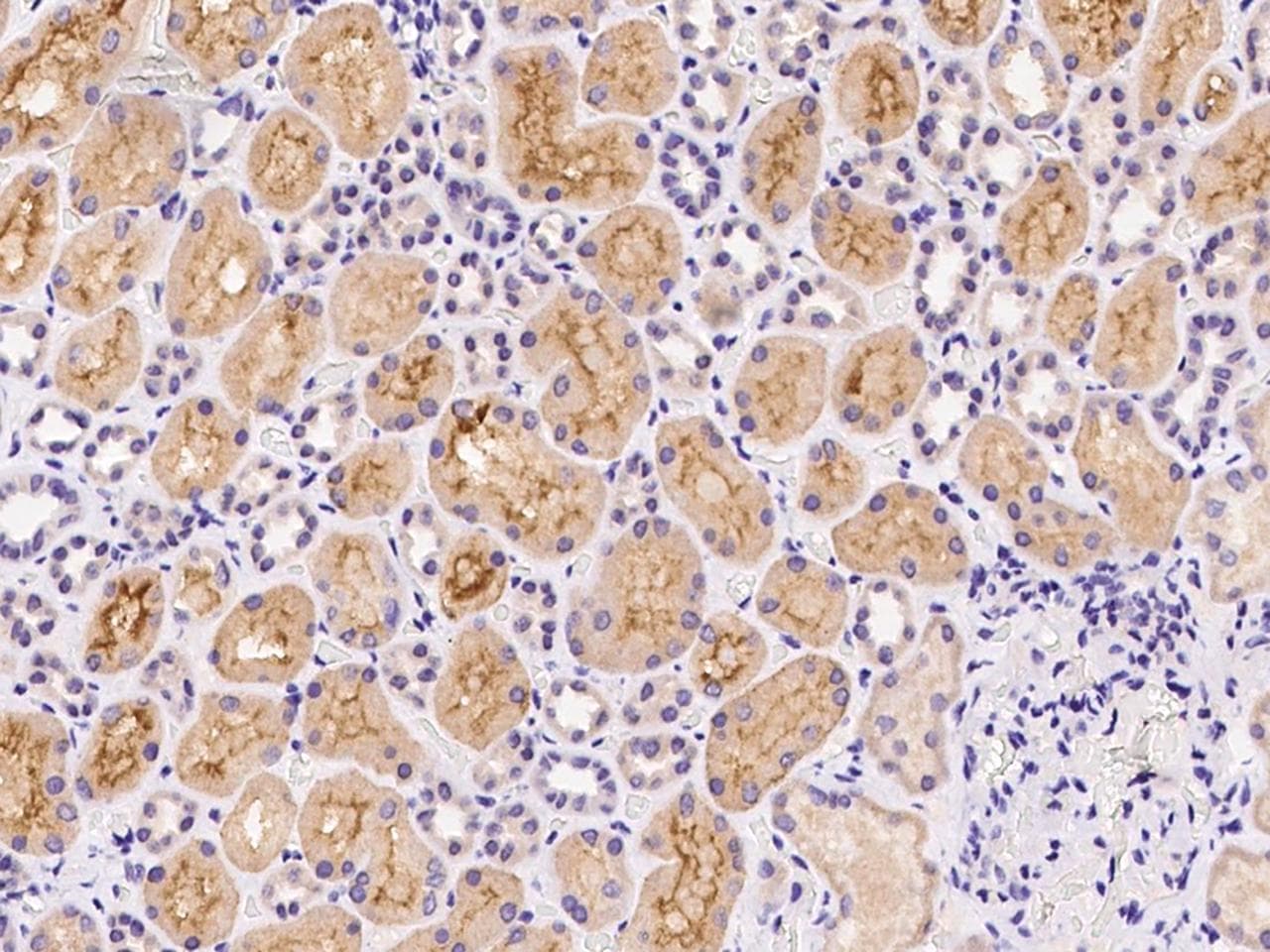 VPS52 / SACM2L Antibody