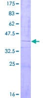 Human ORMDL2 Protein (Recombinant GST)