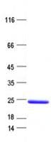 Human ST8SIA4 Protein (Recombinant His, N-Terminal)