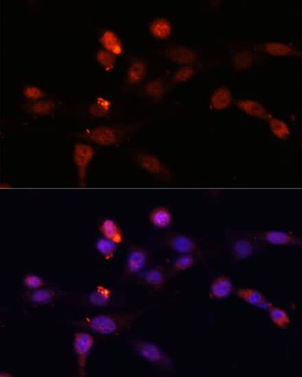 SQSTM1 Antibody
