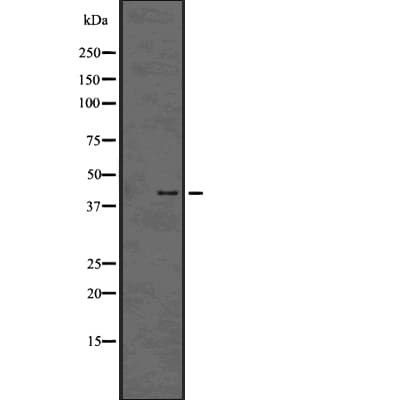SMARCB1 / INI1 Antibody
