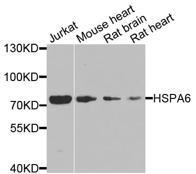 HSPA6 / HSP70B' Antibody