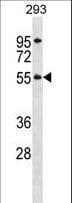 Polyclonal Rabbit anti-Human TTC8 Antibody (aa18-46, WB)