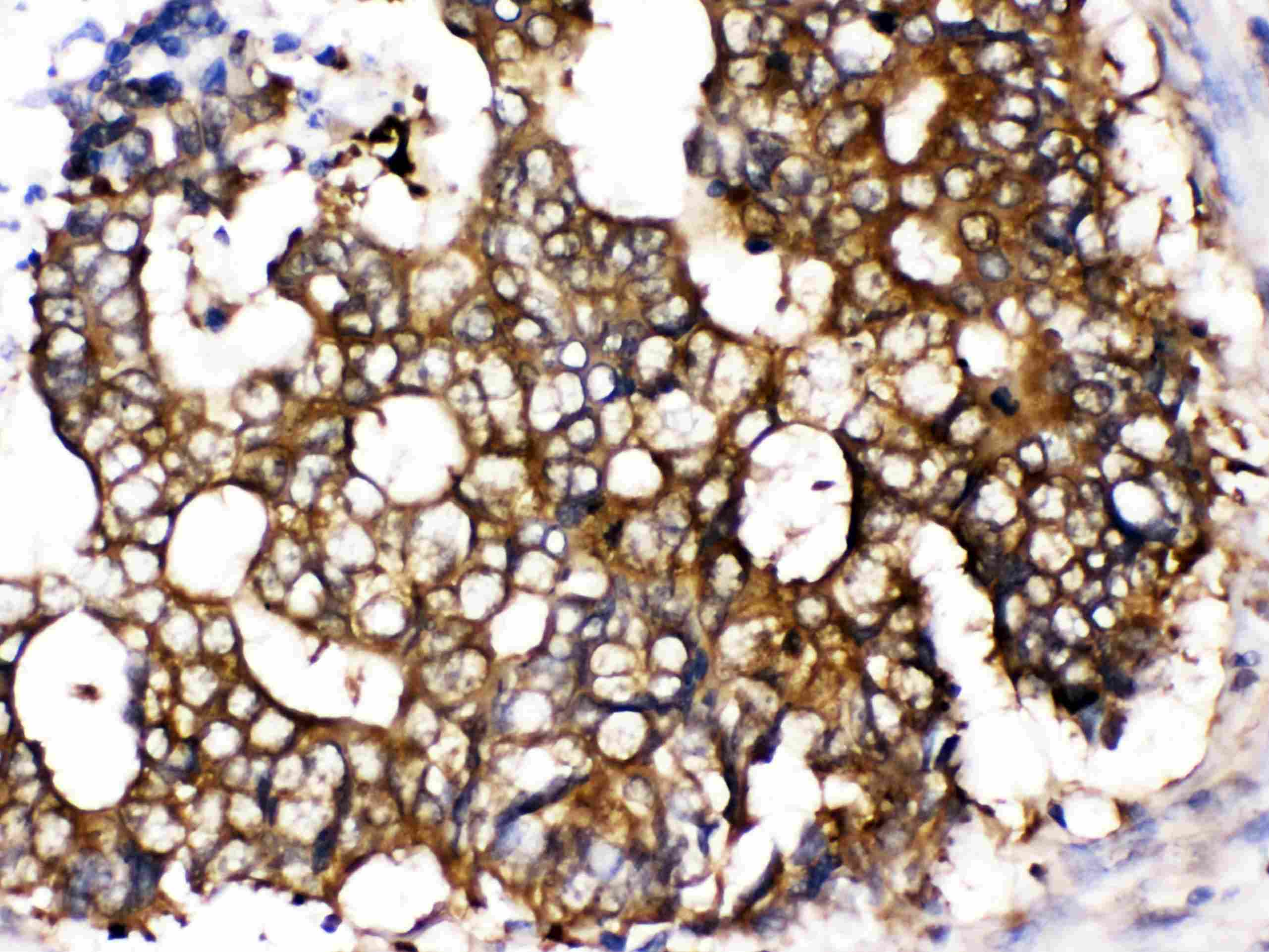 CCT5 / TCP1 Epsilon Antibody