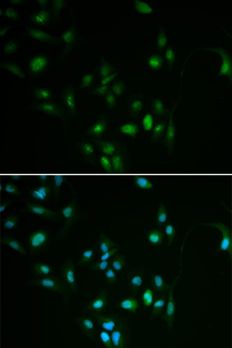 BCL2 / Bcl-2 Antibody