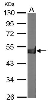 IHC-plus™ CKB / Creatine Kinase BB Antibody (aa165-381)