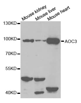 IHC-plus™ AOC3 / VAP-1 Antibody