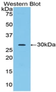 Acrosin Antibody (aa43-291)