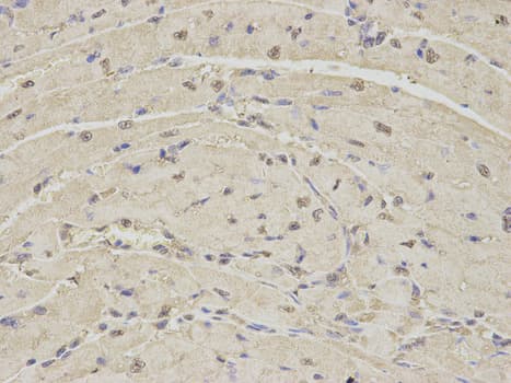 IHC-plus™ Polyclonal Rabbit anti-Human PSMA1 Antibody (IHC, IF, WB)