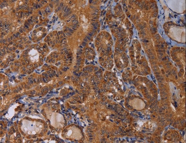 MAGEB10 Antibody