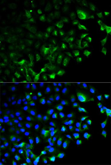 TRAF2 Antibody