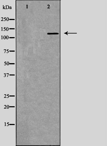 RFC1 / RFC Antibody