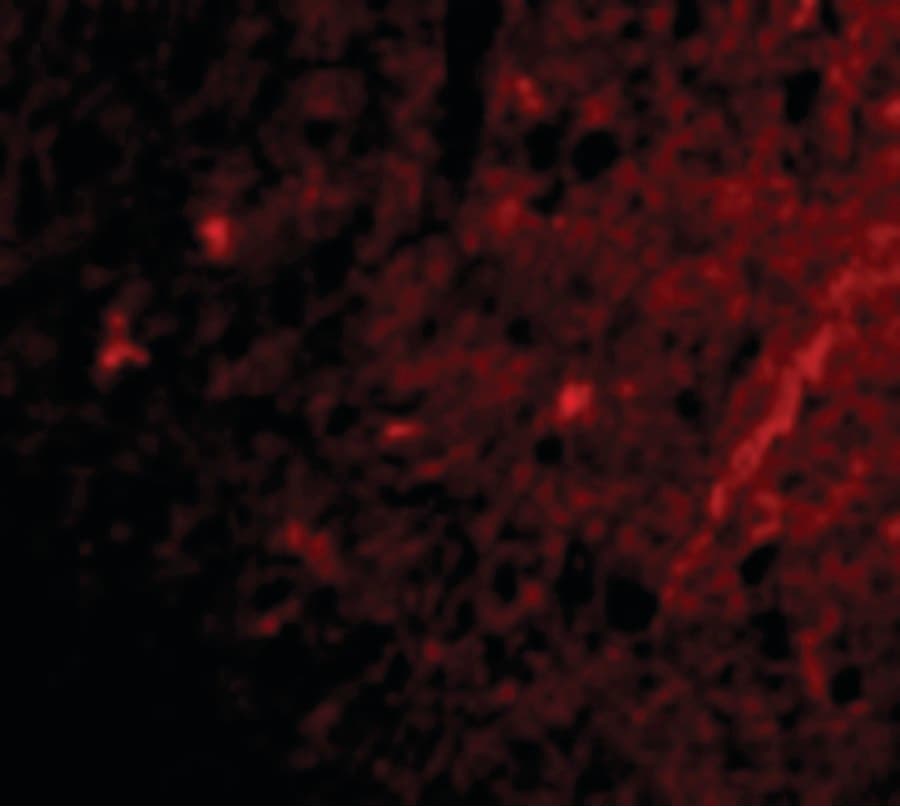 IHC-plus™ Polyclonal Rabbit anti-Human GRIK1 / GLUR5 Antibody (IHC, IF, WB)