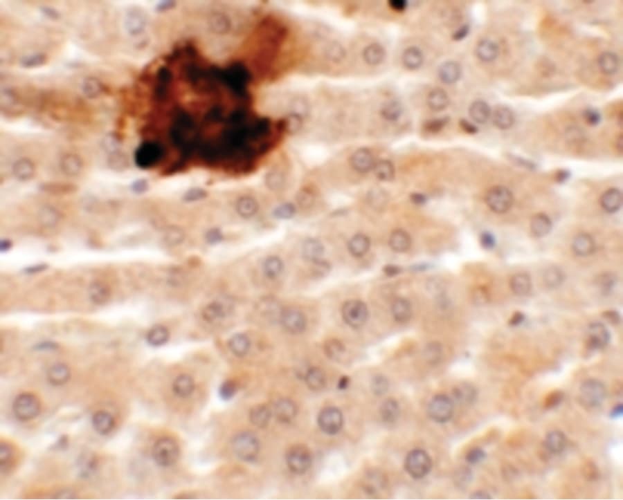 Polyclonal Rabbit anti-Human SYTL5 Antibody (IHC, WB)