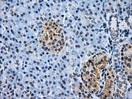HDAC10 Antibody (clone OTI7C3)