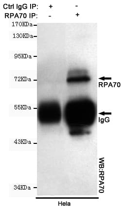 RPA70 / RPA1 Antibody