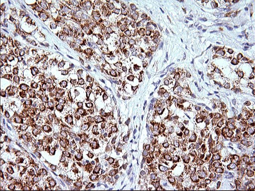 Monoclonal Mouse anti-Human FNDC8 Antibody (clone OTI1C12, IHC, WB)