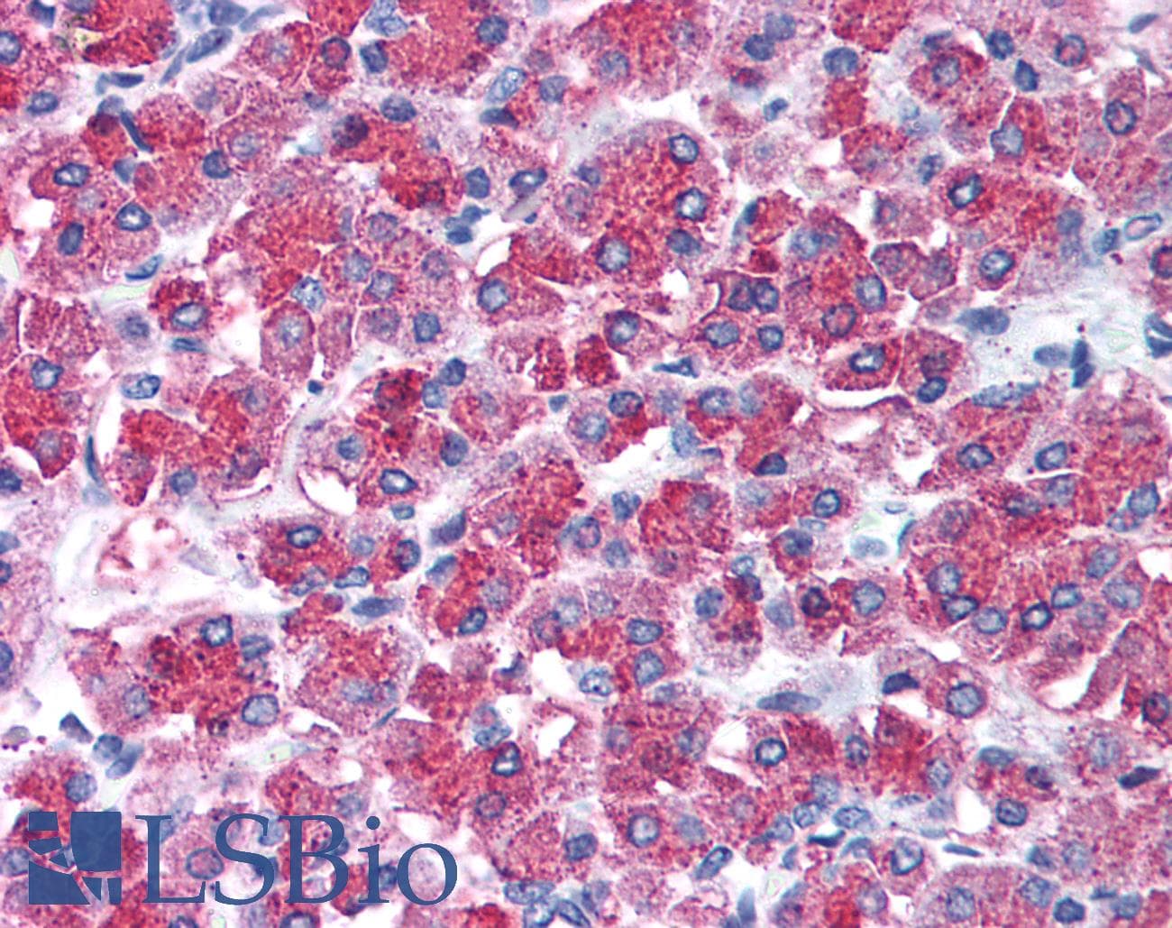 IHC-plus™ SNAI2 / SLUG Antibody