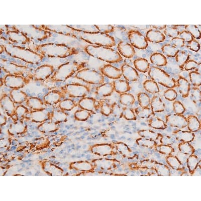 Polyclonal Rabbit anti-Human SYK Antibody (phospho-Tyr348, IHC, IF, WB)