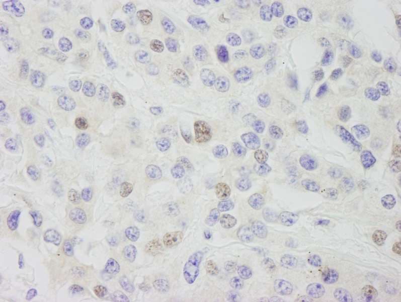 CPSF3L Antibody (aa550-600)