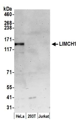 LIMCH1 Antibody (aa250-300)