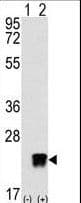IHC-plus™ Polyclonal Rabbit anti-Human ARFL3 / ARL3 Antibody (aa144-173, IHC, WB)
