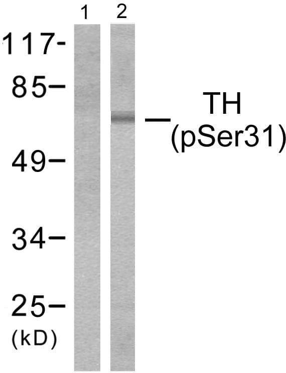 TH / Tyrosine Hydroxylase Antibody (phospho-Ser31)